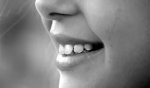 White Stains on Teeth