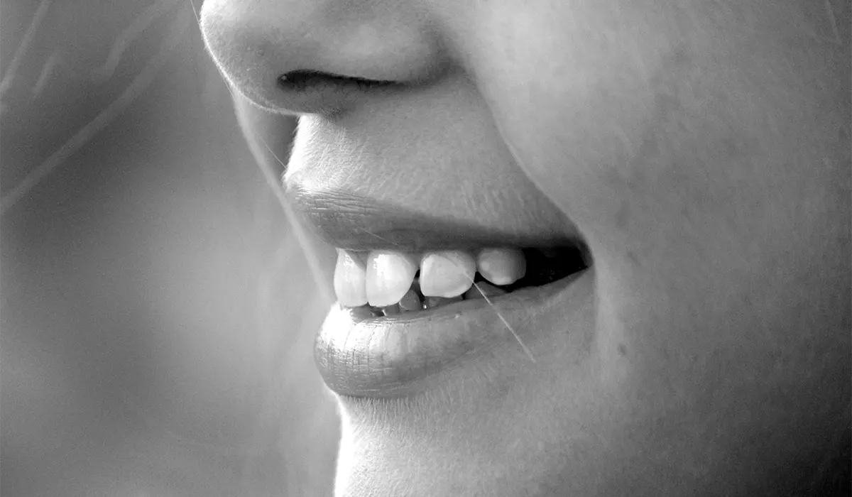 White Stains on Teeth