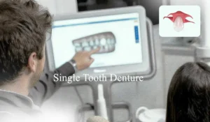 Single Tooth Denture placement monitering