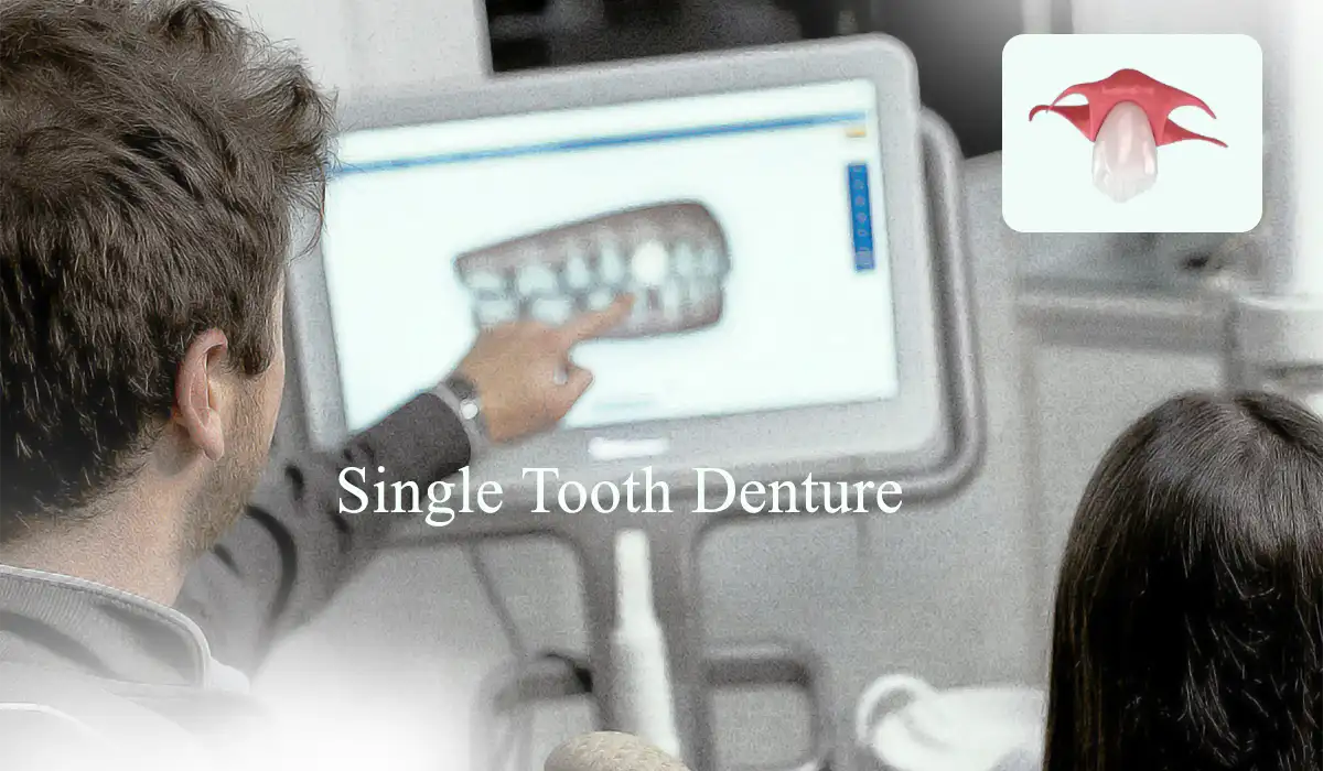 Single Tooth Denture placement monitering