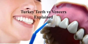Turkey Teeth vs Veneers
