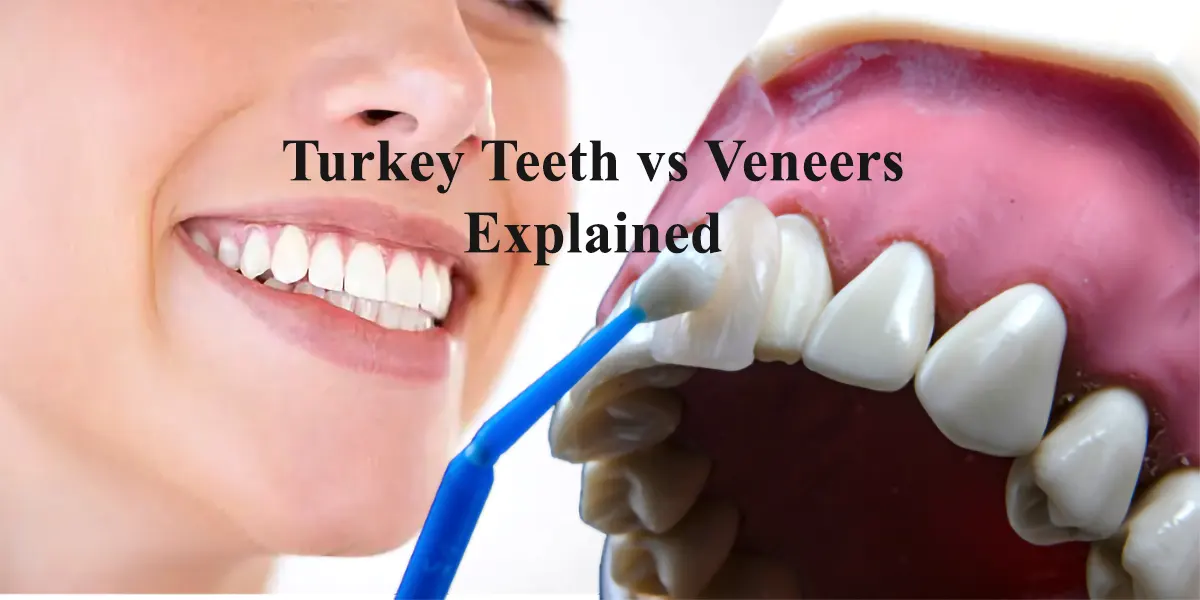 Turkey Teeth vs Veneers