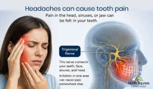 the connection between headaches and tooth pain through the trigeminal nerve pathway, highlighting how facial nerves link the head, jaw, and teeth.